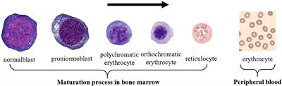 Red Blood Cell Classification Based on Attention Residual Feature Pyramid Network